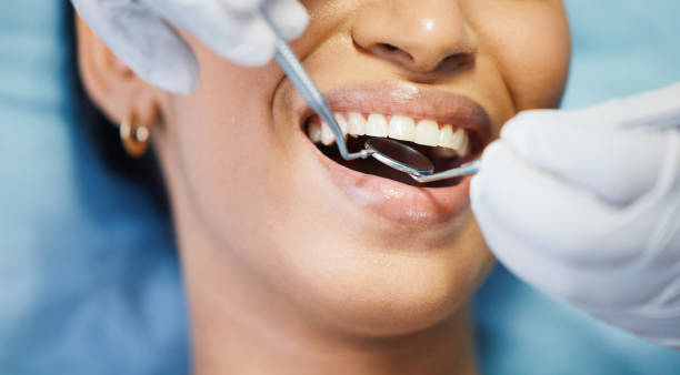 Best Broken or Cracked Tooth Emergency Dentist in Sanger, CA